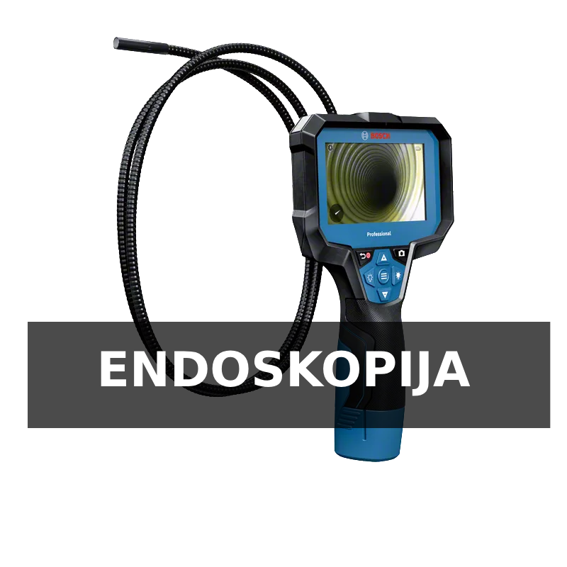 endoskopija beograd snimanje endoskop kamerom